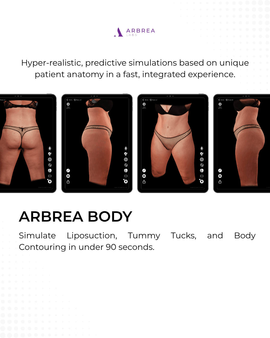 Arbrea preview 8